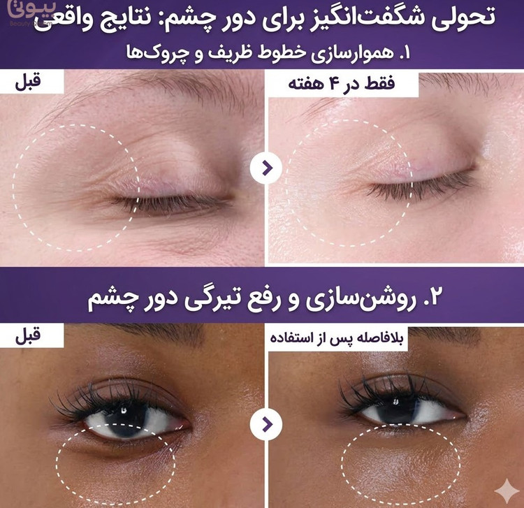 دور چشم 20 میل نامبوزین حاوی nad+ رتینال و پنجاه نوع پپتاید ضد چروک